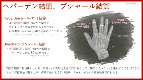 手指の変形