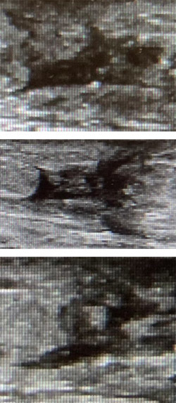 ultrasound05202105.jpg